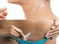 Universal Chef Scar Removal Silicone Gel Sheet